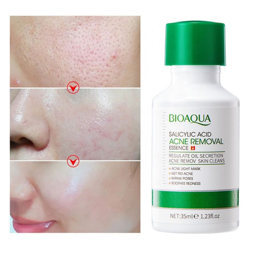 Serum De Acido Salicilico Bioaqua 35ml
