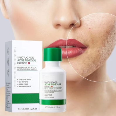 Serum De Acido Salicilico Bioaqua 35ml