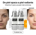 SUNHEAL Sérum Facial Vitamina C 30ml – Ilumina, Mejora la Textura y Unifica el Tono de la Piel