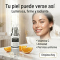 SUNHEAL Sérum Facial Vitamina C 30ml – Ilumina, Mejora la Textura y Unifica el Tono de la Piel