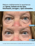 Parche de Gel para Ojos con Cafeína y Ácido Hialurónico Terez & Honor – Reduce Bolsas, Hidrata y Desinflama el Contorno de Ojos