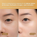 Parches de Gel para Ojos 24K Gold con Retinol Terez & Honor – Hidrata, Reduce Bolsas y Mejora Ojeras